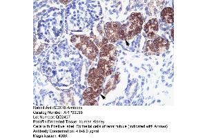 Rabbit Anti-SOX18 Antibody  Paraffin Embedded Tissue: Human Kidney Cellular Data: Epithelial cells of renal tubule Antibody Concentration: 4. (SOX18 Antikörper  (Middle Region))