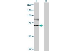 Western Blot analysis of ST6GALNAC1 expression in transfected 293T cell line by ST6GALNAC1 MaxPab polyclonal antibody. (ST6GALNAC1 Antikörper  (AA 1-600))