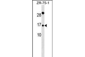 TI Antibody (Center) (ABIN6242753 and ABIN6577350) western blot analysis in ZR-75-1 cell line lysates (35 μg/lane). (TIMM9 Antikörper  (AA 18-44))