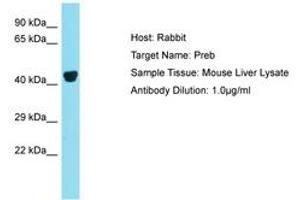 Image no. 1 for anti-Prolactin Regulatory Element Binding (PREB) (N-Term) antibody (ABIN6750398) (PREB Antikörper  (N-Term))