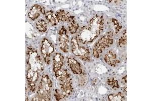 Immunohistochemical staining of human kidney with ESPN polyclonal antibody  shows strong membranous and weak nuclear positivity in tubular cells. (Espin Antikörper)