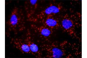 Proximity Ligation Analysis of protein-protein interactions between SNCA and APP. (SNCA Antikörper  (AA 1-140))