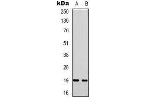 Western blot analysis of STMN1 expression in Hela (A), COS7 (B) whole cell lysates. (Stathmin 1 Antikörper  (N-Term))