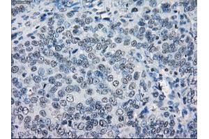 Immunohistochemical staining of paraffin-embedded colon tissue using anti-LTA4Hmouse monoclonal antibody. (LTA4H Antikörper)