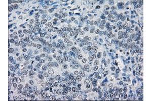 Immunohistochemical staining of paraffin-embedded colon tissue using anti-LTA4Hmouse monoclonal antibody.