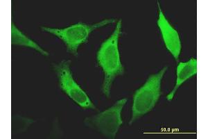 Immunofluorescence of monoclonal antibody to FHIT on HeLa cell.
