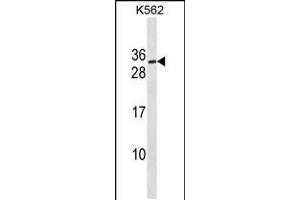 Western blot analysis in K562 cell line lysates (35ug/lane). (SSX3 Antikörper  (AA 53-80))