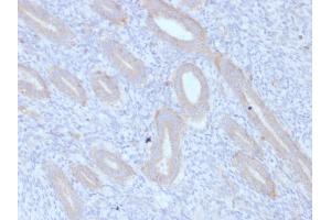Formalin-fixed, paraffin-embedded human Endometrium stained with ATG5 Mouse Monoclonal Antibody (ATG5/2553). (ATG5 Antikörper  (AA 1-119))