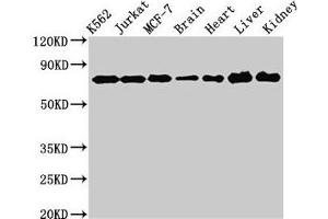 Western Blot Positive WB detected in: K562 whole cell lysate, Jurkat whole cell lysate, MCF-7 whole cell lysate, Rat brain tissue, Rat heart tissue, Mouse liver tissue, Mouse kidney tissue All lanes: DDX3X antibody at 3 μg/mL Secondary Goat polyclonal to rabbit IgG at 1/50000 dilution Predicted band size: 74, 72 kDa Observed band size: 74 kDa (DDX3X Antikörper  (AA 2-662))