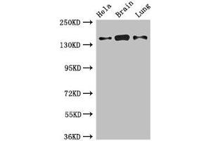 Western Blot Positive WB detected in: Hela whole cell lysate, Mouse brain tissue, Rat lung tissue All lanes: SULF2 antibody at 2. (SULF2 Antikörper  (AA 463-660))