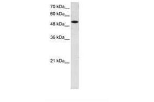 Image no. 1 for anti-Solute Carrier Family 25 (Mitochondrial Carrier, Phosphate Carrier), Member 25 (SLC25A25) (AA 71-120) antibody (ABIN6736655) (SLC25A25 Antikörper  (AA 71-120))