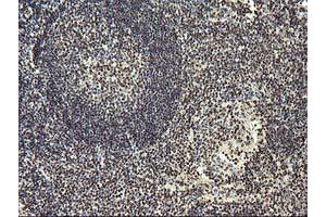 Image no. 8 for anti-O-Sialoglycoprotein Endopeptidase (OSGEP) (AA 1-335) antibody (ABIN1490751)