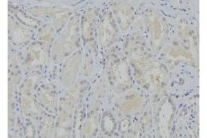 ABIN6273751 at 1/100 staining Mouse kidney tissue by IHC-P. (CYP17A1 Antikörper  (Internal Region))
