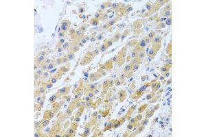 Immunohistochemistry of paraffin-embedded human liver using STC1 antibody at dilution of 1:100 (40x lens). (Stanniocalcin 1 Antikörper)