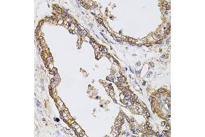 Immunohistochemistry of paraffin-embedded human prostate using CAST antibody (ABIN5970004) at dilution of 1/100 (40x lens). (Calpastatin Antikörper)