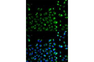 Immunofluorescence analysis of A549 cells using ATG13 antibody.