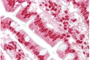 Anti-OAS1 antibody IHC staining of human small intestine. (OAS1 Antikörper  (AA 324-373))