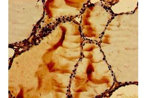 Immunohistochemistry of paraffin-embedded human thyroid tissue using ABIN7167354 at dilution of 1:100 (RAB5 Antikörper  (AA 1-215))