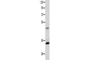 Western Blotting (WB) image for anti-Melanocortin 1 Receptor (MC1R) antibody (ABIN2426175)