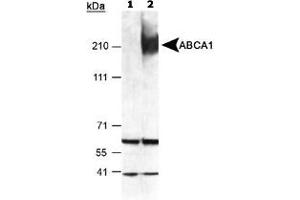 Detection of ABCA1 in mouse peritoneal macrophages using ABCA1 polyclonal antibody . (ABCA1 Antikörper  (AA 1100-1300))