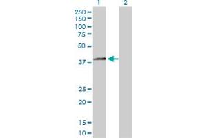 Western Blot analysis of HSD3B2 expression in transfected 293T cell line by HSD3B2 MaxPab polyclonal antibody. (HSD3B2 Antikörper  (AA 1-372))