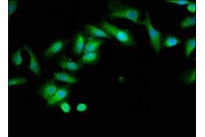 Immunofluorescence staining of Hela cells with ABIN7173964 at 1:133, counter-stained with DAPI. (INPP5B Antikörper  (AA 78-178))