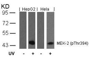 Western blot analysis of extracts from HepG2 and Hela cells untreated or treated with UV using MEK-2(Phospho-Thr394) Antibody. (MEK2 Antikörper  (pThr394))