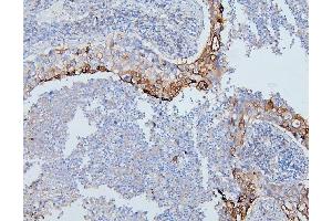 IHC analysis of PYROXD1 using anti-PYROXD1 antibody (ABIN6719650). (PYROXD1 Antikörper  (AA 48-230))