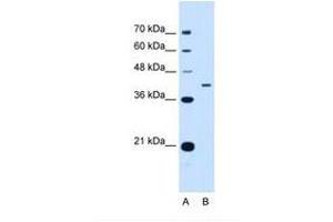 Image no. 1 for anti-Apolipoprotein H (Beta-2-Glycoprotein I) (APOH) (AA 71-120) antibody (ABIN6738750) (APOH Antikörper  (AA 71-120))