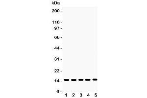 Western blot testing of Profilin-1 antibody and Lane 1:  rat testis;  2: mouse testis;  3: human placenta;  4: (h) PANC;  5: (h) SW620 lysate. (PFN1 Antikörper  (C-Term))