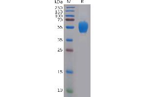 SDS-PAGE (SDS) image for Fibroblast Growth Factor Receptor 4 (FGFR4) (AA 22-369) protein (His tag) (ABIN7092749)