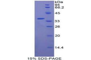 SDS-PAGE analysis of Human CRAF Protein. (CRAF Protein)
