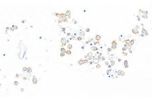 Immunohistochemistry (IHC) image for anti-Hepatitis A Virus Cellular Receptor 2 (TIM 3) (AA 22-201) antibody (ABIN7449550) (Rekombinanter TIM3 Antikörper  (AA 22-201))