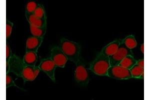 ABIN6383801 to EpCAM was successfully used to stain cellular membranes in cell line MCF7 and in human colorectal carcinoma. (EpCAM Antikörper  (Extracellular Domain))