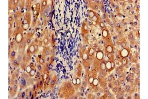 Immunohistochemistry of paraffin-embedded human liver tissue using ABIN7174631 at dilution of 1:100 (UGT1A9 Antikörper  (AA 277-473))