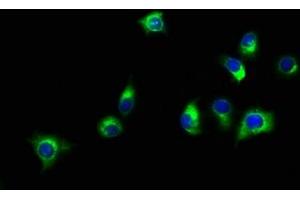 Immunofluorescence staining of A549 cells with ABIN7160157 at 1:150, counter-stained with DAPI. (SLC16A11 Antikörper  (AA 428-471))