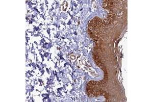 Immunohistochemical staining of human skin with FOPNL polyclonal antibody  shows strong cytoplasmic positivity in epidermal cells at 1:50-1:200 dilution. (FOPNL Antikörper)
