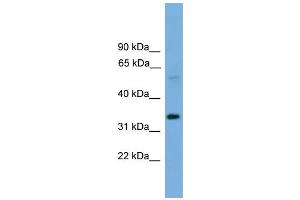 WB Suggested Anti-TM7SF4 Antibody Titration:  0.