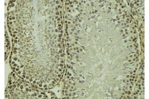 ABIN6269090 at 1/100 staining Mouse testis tissue by IHC-P. (Integrin beta 3 Antikörper  (C-Term))