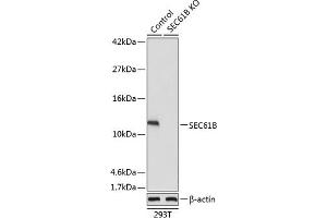 Western blot analysis of extracts from normal (control) and SEC61B knockout (KO) 293T cells, using SEC61B antibody (ABIN7270173) at 1:1000 dilution.
