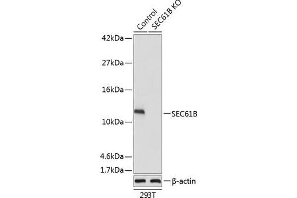SEC61B Antikörper  (AA 1-96)