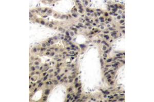 Immunohistochemistry (IHC) image for anti-Eukaryotic Translation Initiation Factor 4E Binding Protein 1 (EIF4EBP1) (pThr45) antibody (ABIN3019842) (eIF4EBP1 Antikörper  (pThr45))