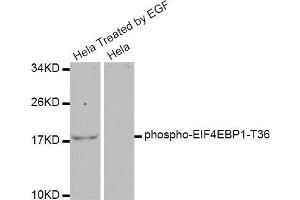 Western blot analysis of extracts of various cell lines, using EIF4EBP1 antibody. (eIF4EBP1 Antikörper  (pThr37, pThr46))