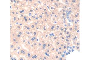 IHC-P analysis of liver tissue, with DAB staining. (ACAA1 Antikörper  (AA 182-424))