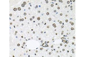 Immunohistochemistry of paraffin-embedded Mouse liver using HDAC3 Polyclonal Antibody at dilution of 1:100 (40x lens). (HDAC3 Antikörper)