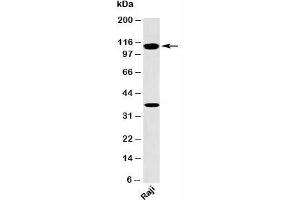 Western blot testing of human samples with TLR9 antibody at 2ug/ml.