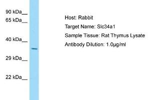 Host: Rabbit Target Name: Slc34a1 Sample Type: Rat Thymus lysates Antibody Dilution: 1. (Solute Carrier Family 34 (Type II Sodium/phosphate Contransporter), Member 1 (SLC34A1) (N-Term) Antikörper)