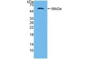 Detection of Recombinant AASS, Human using Polyclonal Antibody to Aminoadipate Semialdehyde Synthase (AASS) (AASS Antikörper  (AA 33-455))