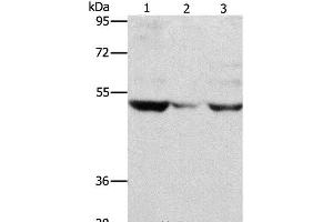 Western Blot analysis of PC3 cell and Mouse muscle tissue, A375 cell using MMP1 Polyclonal Antibody at dilution of 1:500 (MMP1 Antikörper)