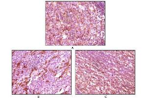Immunohistochemical analysis of paraffin-embedded human lymph tissue (A), glioma tissue (B) and cerebellum tissue (C), showing membrane localization using Dynamin1 mouse mAb with DAB staining (Dynamin 1 Antikörper)